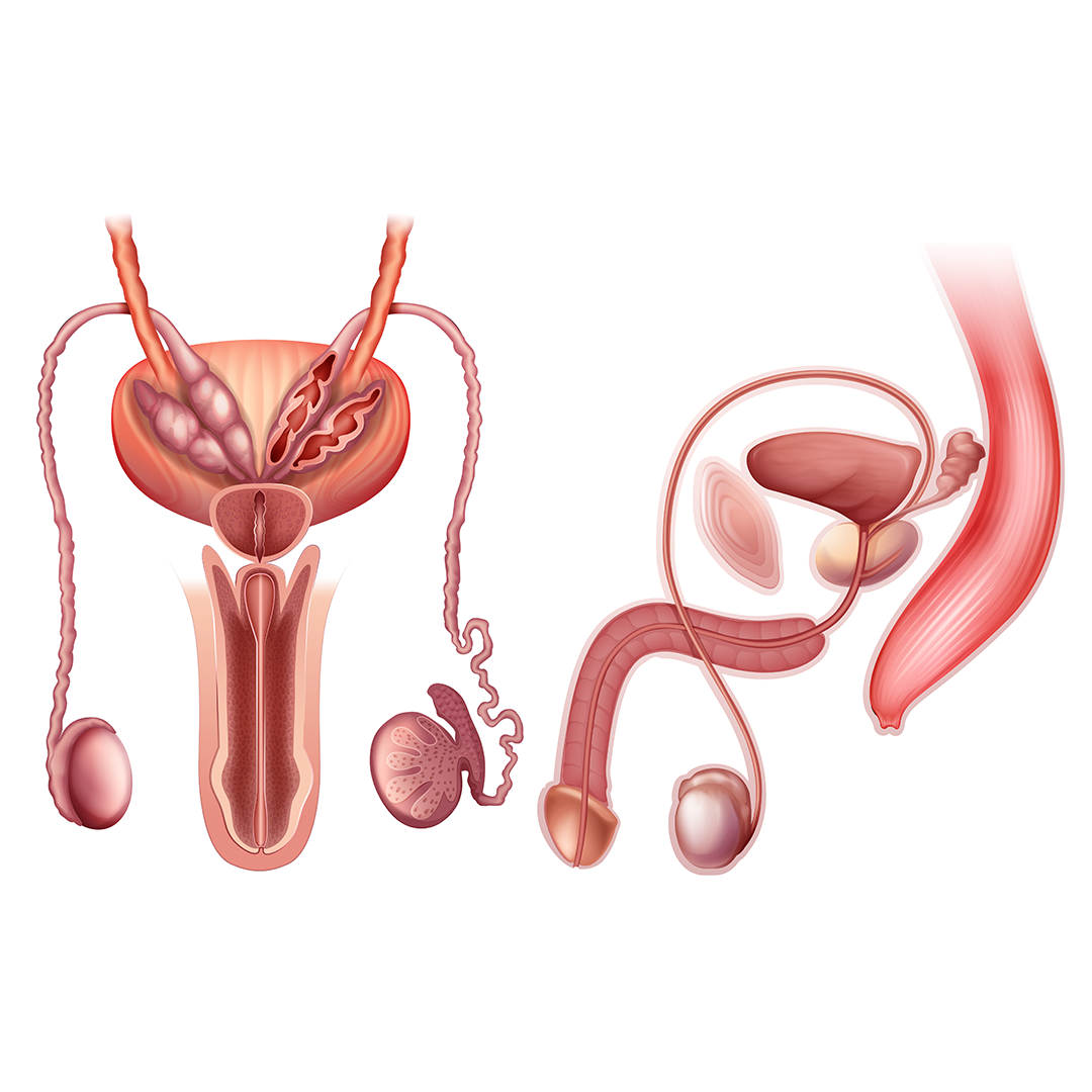 Prostatectomy (Open, Laparoscopic)