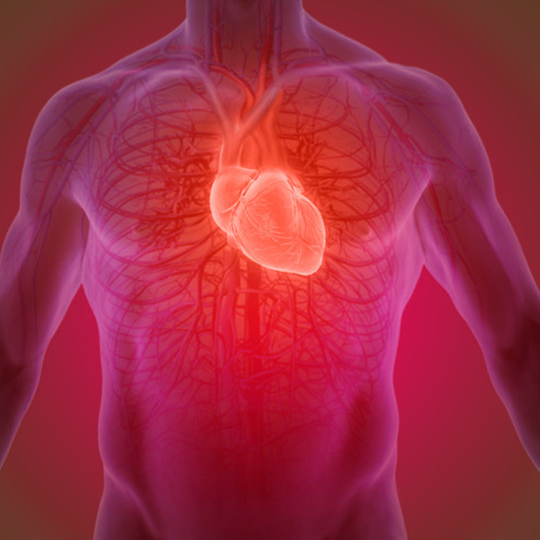 Cardiac Catheterization