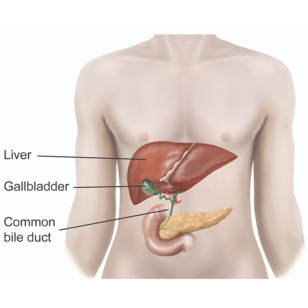 Laparoscopic Cholecystectomy