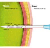 Percutaneous Drainage